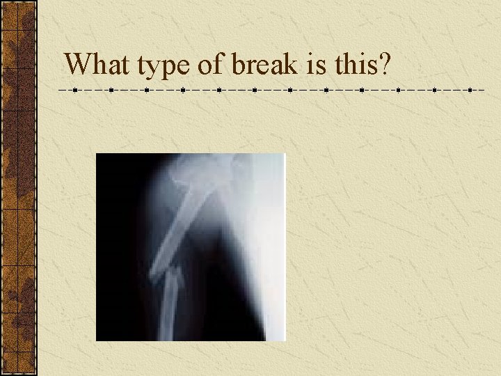 What type of break is this? 