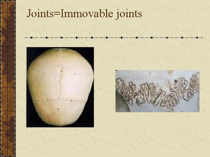 Joints=Immovable joints 