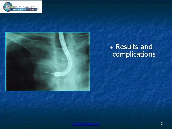 Results and complications bronchoscopy. org 2 