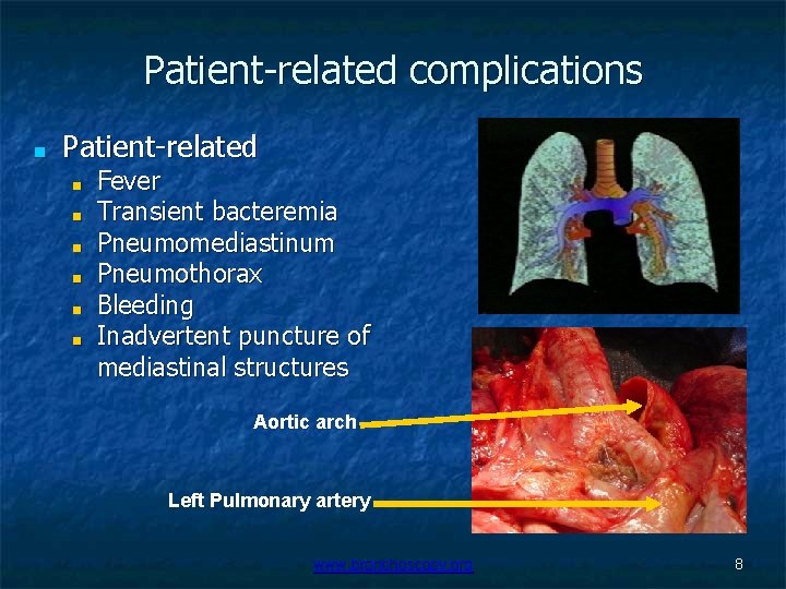 Patient-related complications ■ Patient-related ■ ■ ■ Fever Transient bacteremia Pneumomediastinum Pneumothorax Bleeding Inadvertent