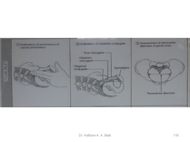 Dr. Haitham A. A. Badr 116 