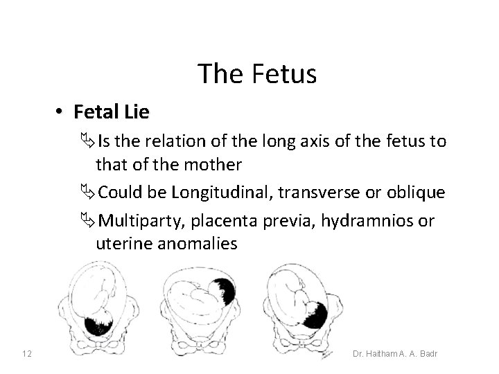 The Fetus • Fetal Lie ÄIs the relation of the long axis of the