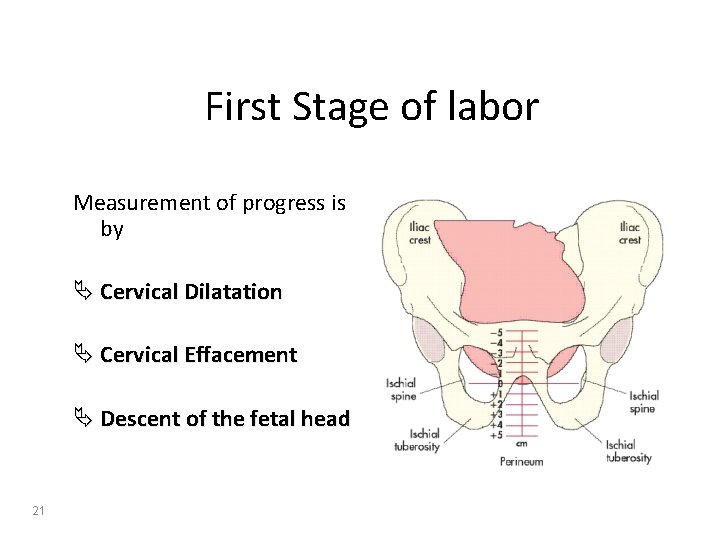 First Stage of labor Measurement of progress is by Ä Cervical Dilatation Ä Cervical