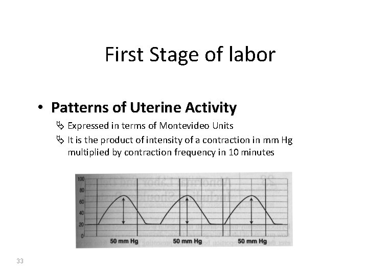 First Stage of labor • Patterns of Uterine Activity Ä Expressed in terms of