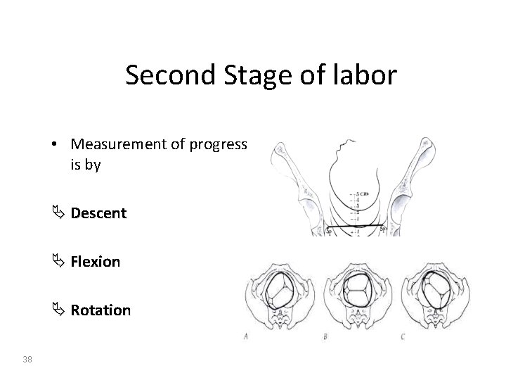 Second Stage of labor • Measurement of progress is by Ä Descent Ä Flexion