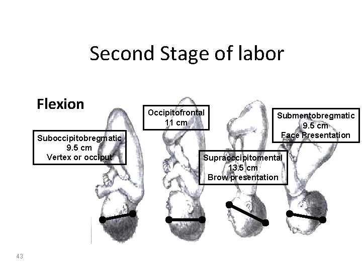Second Stage of labor Flexion Suboccipitobregmatic 9. 5 cm Vertex or occiput 43 Occipitofrontal