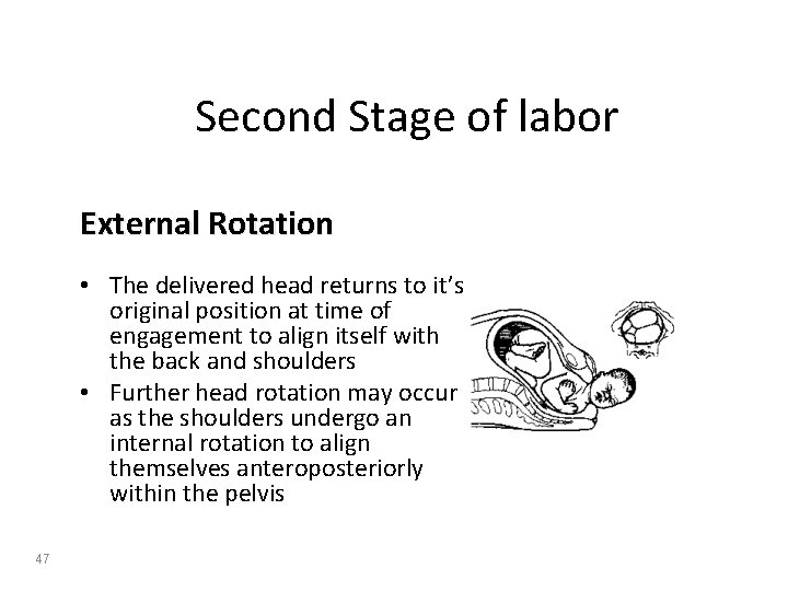 Second Stage of labor External Rotation • The delivered head returns to it’s original