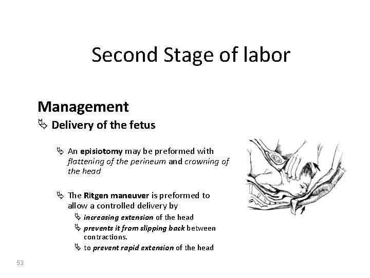 Second Stage of labor Management Ä Delivery of the fetus Ä An episiotomy may