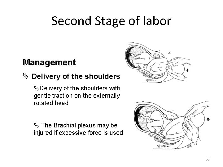 Second Stage of labor Management Ä Delivery of the shoulders ÄDelivery of the shoulders