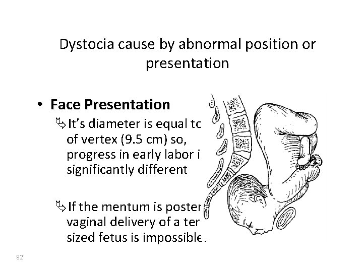 Dystocia cause by abnormal position or presentation • Face Presentation ÄIt’s diameter is equal