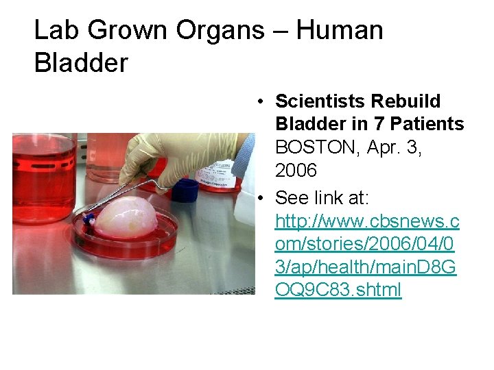 Lab Grown Organs – Human Bladder • Scientists Rebuild Bladder in 7 Patients BOSTON,