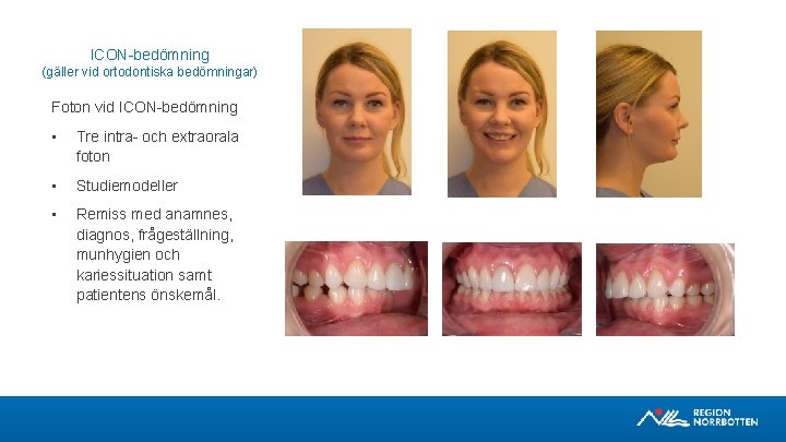ICON-bedömning (gäller vid ortodontiska bedömningar) Foton vid ICON-bedömning • Tre intra- och extraorala foton