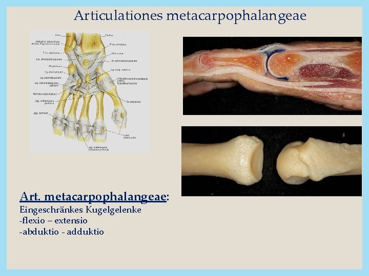 Articulationes metacarpophalangeae Art. metacarpophalangeae: Eingeschränkes Kugelgelenke -flexio – extensio -abduktio - adduktio 