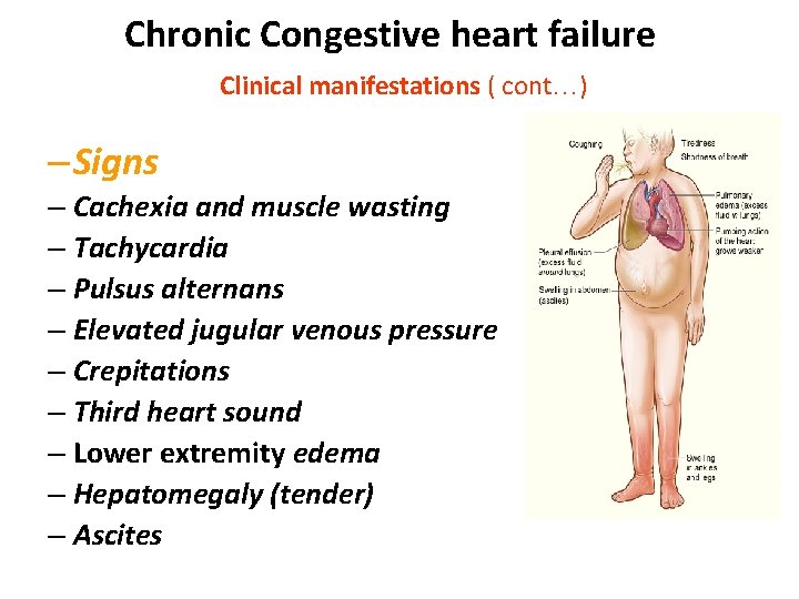 Chronic Congestive heart failure Clinical manifestations ( cont…) – Signs – Cachexia and muscle