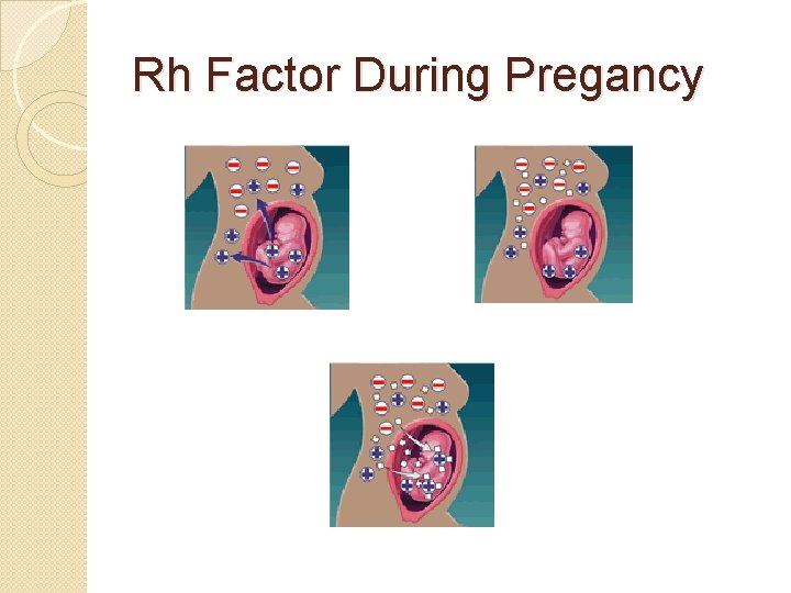 Rh Factor During Pregancy 