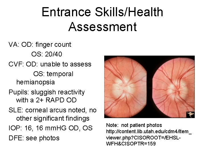 Entrance Skills/Health Assessment VA: OD: finger count OS: 20/40 CVF: OD: unable to assess