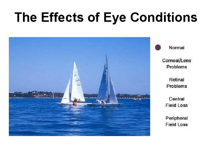 The Effects of Eye Conditions 