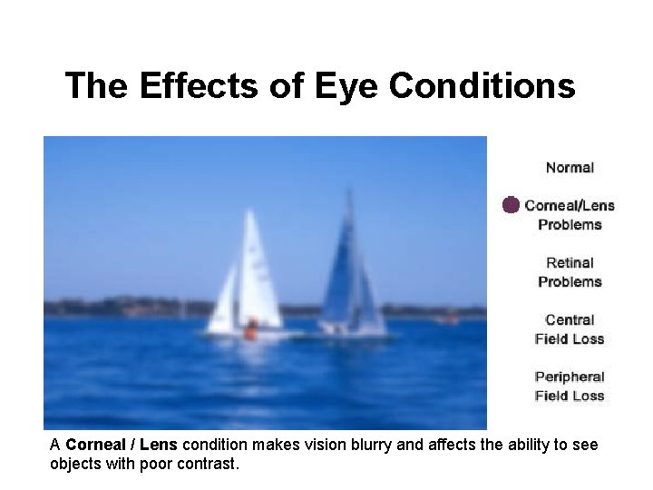 The Effects of Eye Conditions A Corneal / Lens condition makes vision blurry and