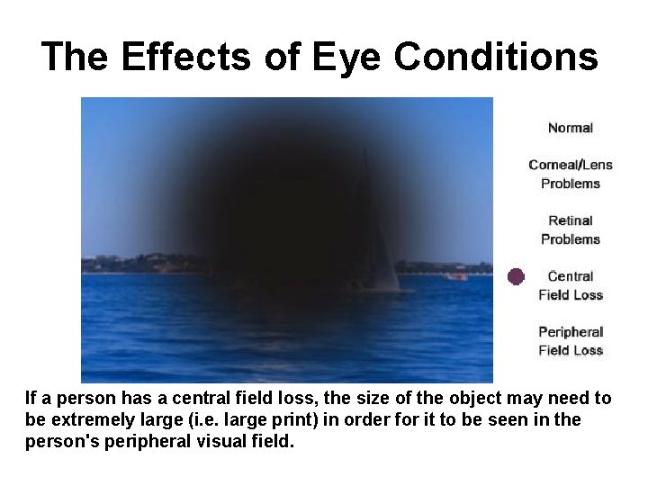 The Effects of Eye Conditions If a person has a central field loss, the