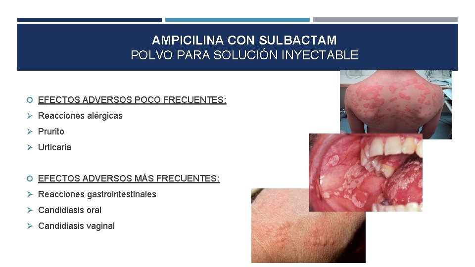 AMPICILINA CON SULBACTAM POLVO PARA SOLUCIÓN INYECTABLE EFECTOS ADVERSOS POCO FRECUENTES: Reacciones alérgicas Prurito