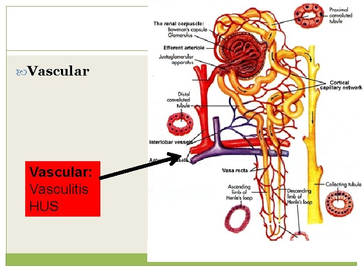 Vascular: Vasculitis HUS 