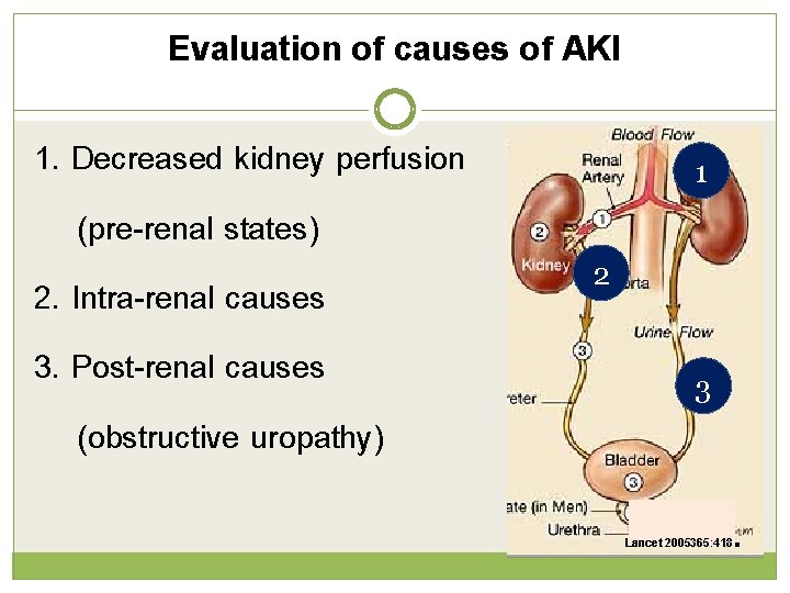 Evaluation of causes of AKI 1. Decreased kidney perfusion (pre-renal states) 2. Intra-renal causes