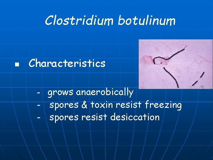 Clostridium botulinum n Characteristics - grows anaerobically - spores & toxin resist freezing -