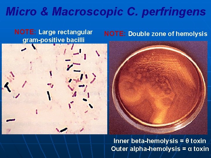 Micro & Macroscopic C. perfringens NOTE: Large rectangular gram-positive bacilli NOTE: Double zone of