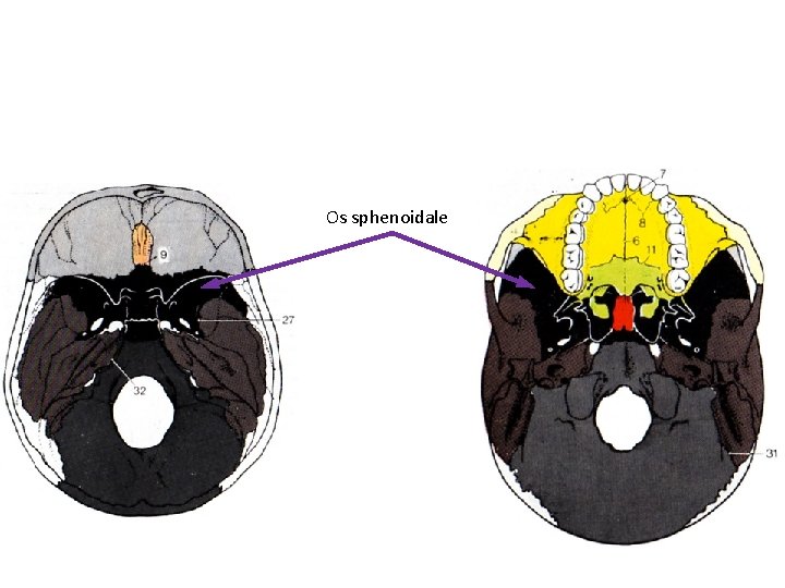 Os sphenoidale 