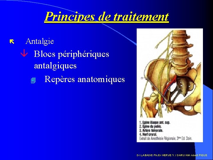 Principes de traitement ë Antalgie â Blocs périphériques antalgiques 4 Repères anatomiques Dr L.