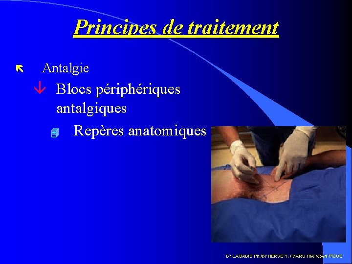 Principes de traitement ë Antalgie â Blocs périphériques antalgiques 4 Repères anatomiques Dr L.