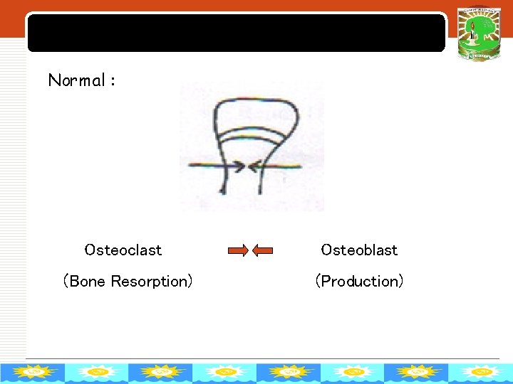 LOGO Normal : Osteoclast (Bone Resorption) Osteoblast (Production) 