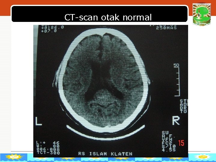 CT-scan otak normal LOGO 