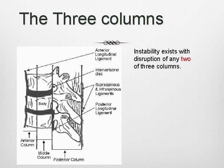 The Three columns Instability exists with disruption of any two of three columns. 