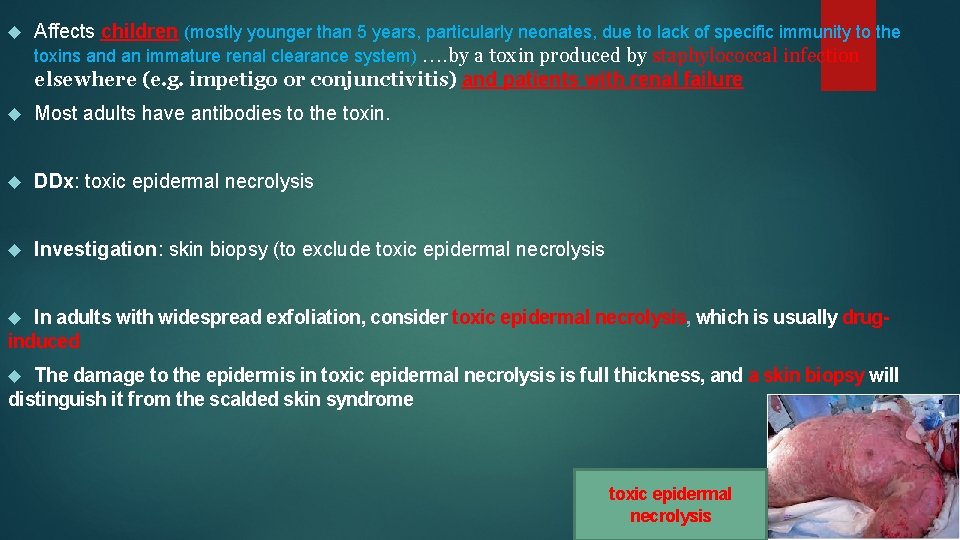  Affects children (mostly younger than 5 years, particularly neonates, due to lack of