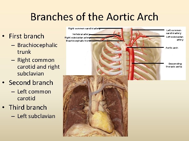 Branches of the Aortic Arch Right common carotid artery • First branch – Brachiocephalic