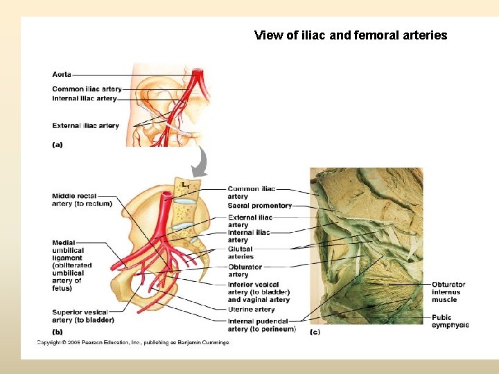 View of iliac and femoral arteries 