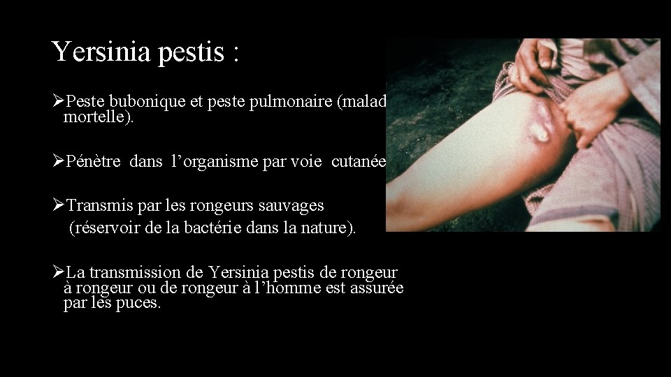 Yersinia pestis : ØPeste bubonique et peste pulmonaire (maladie mortelle). ØPénètre dans l’organisme par