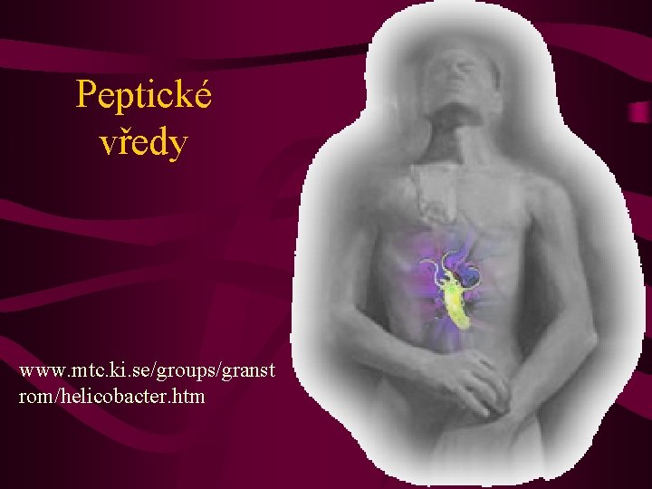 Peptické vředy www. mtc. ki. se/groups/granst rom/helicobacter. htm 