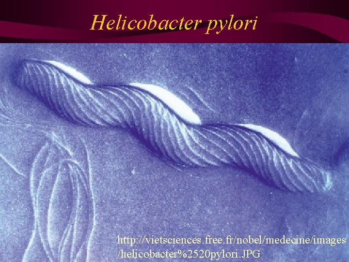 Helicobacter pylori http: //vietsciences. free. fr/nobel/medecine/images /helicobacter%2520 pylori. JPG 