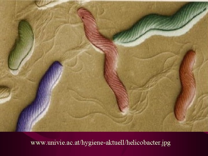 www. univie. ac. at/hygiene-aktuell/helicobacter. jpg 