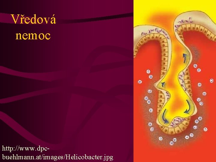 Vředová nemoc http: //www. dpcbuehlmann. at/images/Helicobacter. jpg 