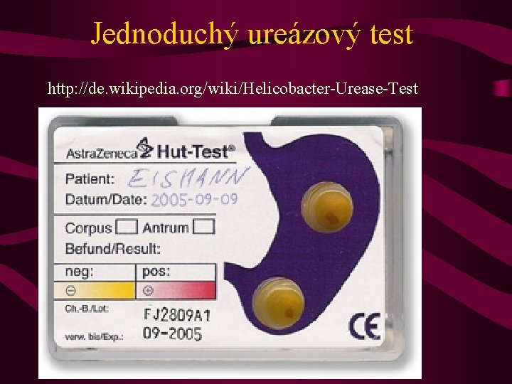 Jednoduchý ureázový test http: //de. wikipedia. org/wiki/Helicobacter-Urease-Test 