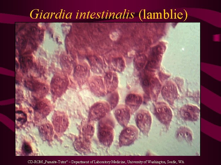 Giardia intestinalis (lamblie) CD-ROM „Parasite-Tutor“ – Department of Laboratory Medicine, University of Washington, Seatle,