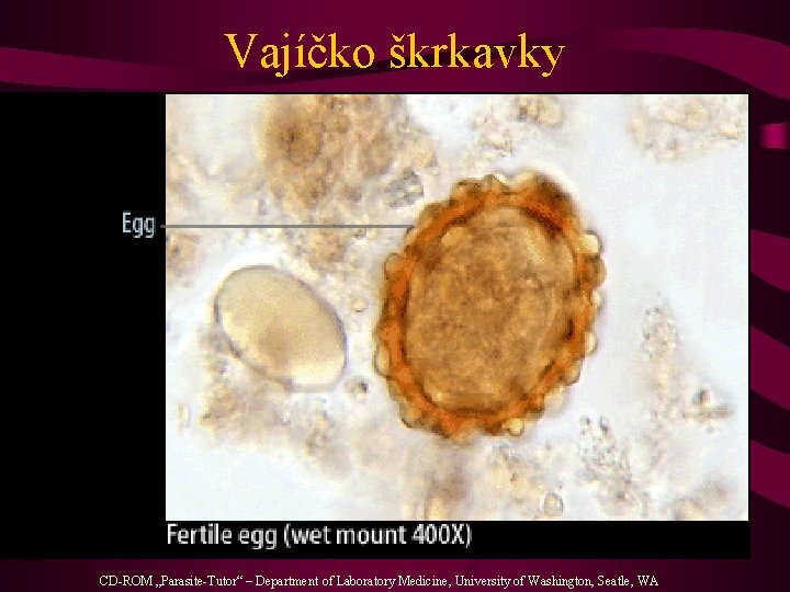 Vajíčko škrkavky CD-ROM „Parasite-Tutor“ – Department of Laboratory Medicine, University of Washington, Seatle, WA