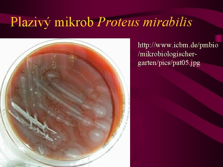 Plazivý mikrob Proteus mirabilis http: //www. icbm. de/pmbio /mikrobiologischergarten/pics/pat 05. jpg 