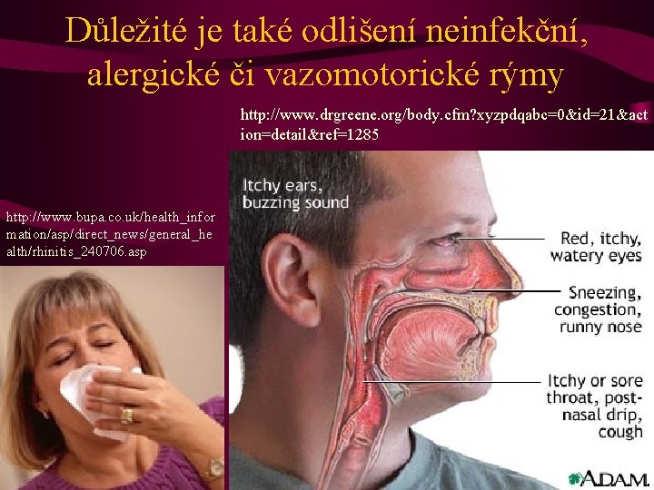 Důležité je také odlišení neinfekční, alergické či vazomotorické rýmy http: //www. drgreene. org/body. cfm?