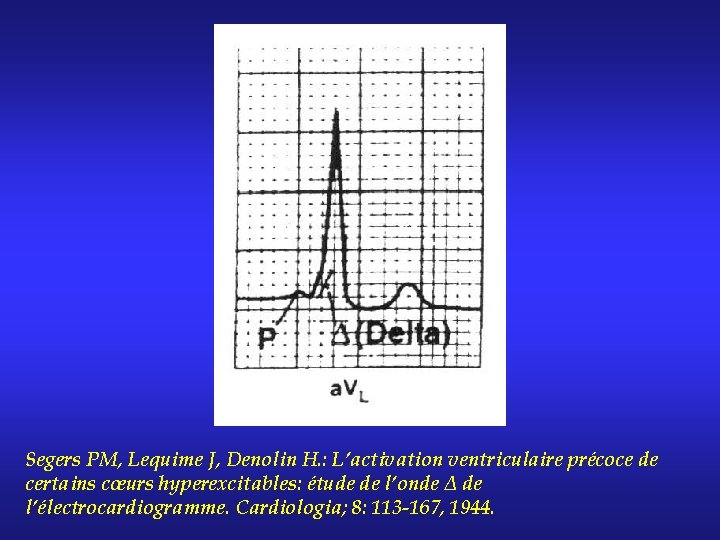 Segers PM, Lequime J, Denolin H. : L’activation ventriculaire précoce de certains cœurs hyperexcitables: