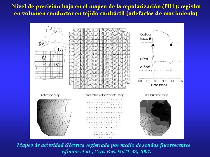 Nivel de precisión bajo en el mapeo de la repolarización (PRE): registro en volumen