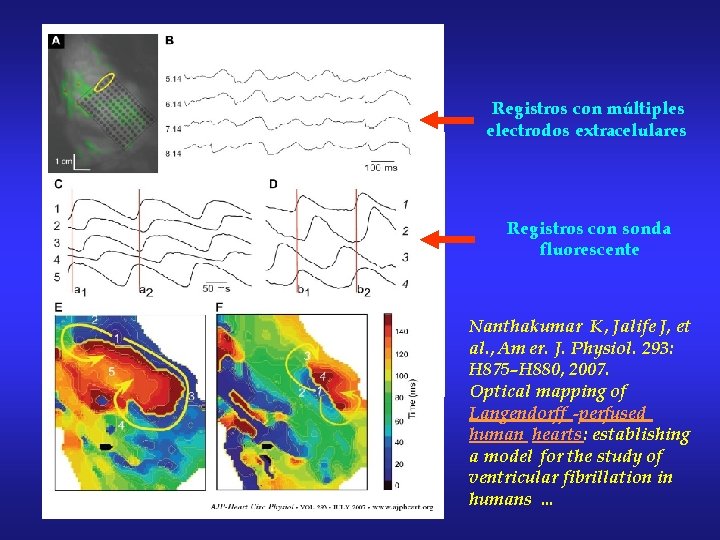 Registros con múltiples electrodos extracelulares Registros con sonda fluorescente Nanthakumar K, Jalife J, et